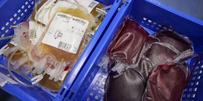 Blood Donations In Hull Will Help Make Rare Disease Medicines